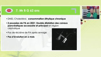 ECHO-ENDOSCOPIE ET PANCREATOSCOPIE