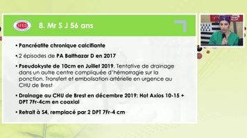 DRAINAGE PSEUDOKYSTE