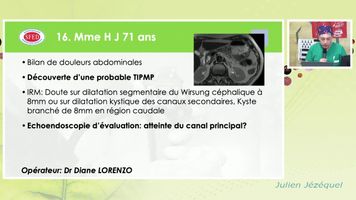 ECHOENDOSCOPIE D'EVALUATION