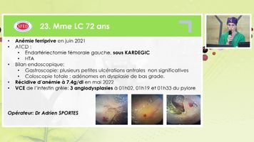 ENTEROSCOPIE SPIRALEE