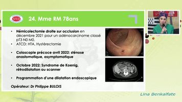DILATATION ENDOSCOPIQUE