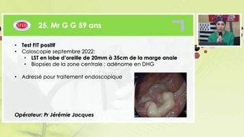 TRAITEMENT ENDOSCOPIQUE