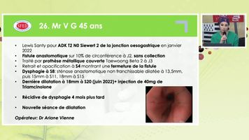 SEANCE DE DILATATION