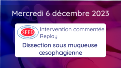 Intervention commentée : le replay est en ligne !