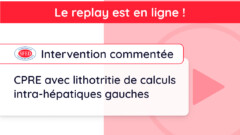Replay de l’Intervention commentée du vendredi 1er mars