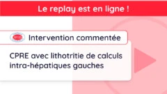 Replay de l’Intervention commentée du vendredi 1er mars