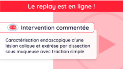 Replay de l’intervention commentée du jeudi 28 mars