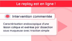 Replay de l’intervention commentée du jeudi 28 mars