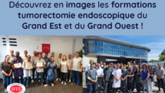 Découvrez en images les formations tumorectomie endoscopique du Grand Est et du Grand Ouest !
