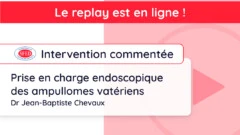 Replay de l’intervention commentée du jeudi 7 novembre 2024