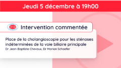Replay de l’intervention commentée du jeudi 5 décembre 2024