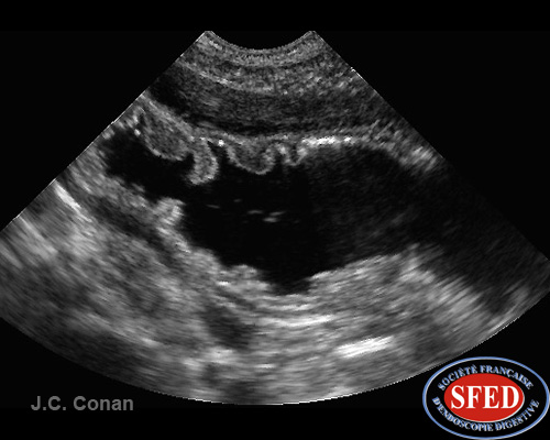 Funus Normal Fundus normal – SFED